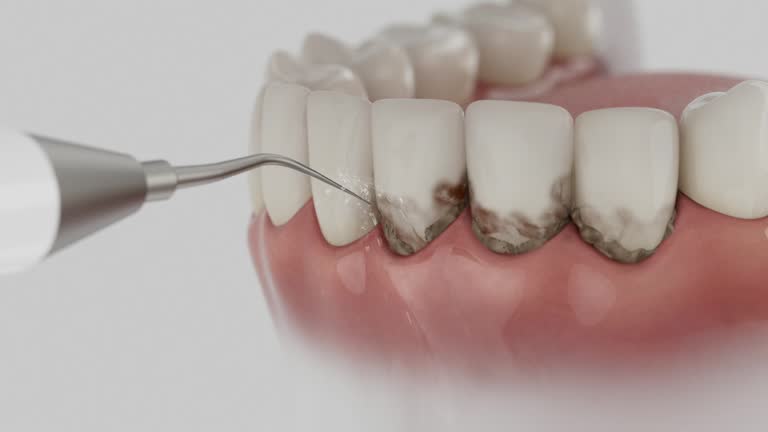 Trusted Teeth Cleaning And Checkup service in Litchfield, IL - Dentist Open Now